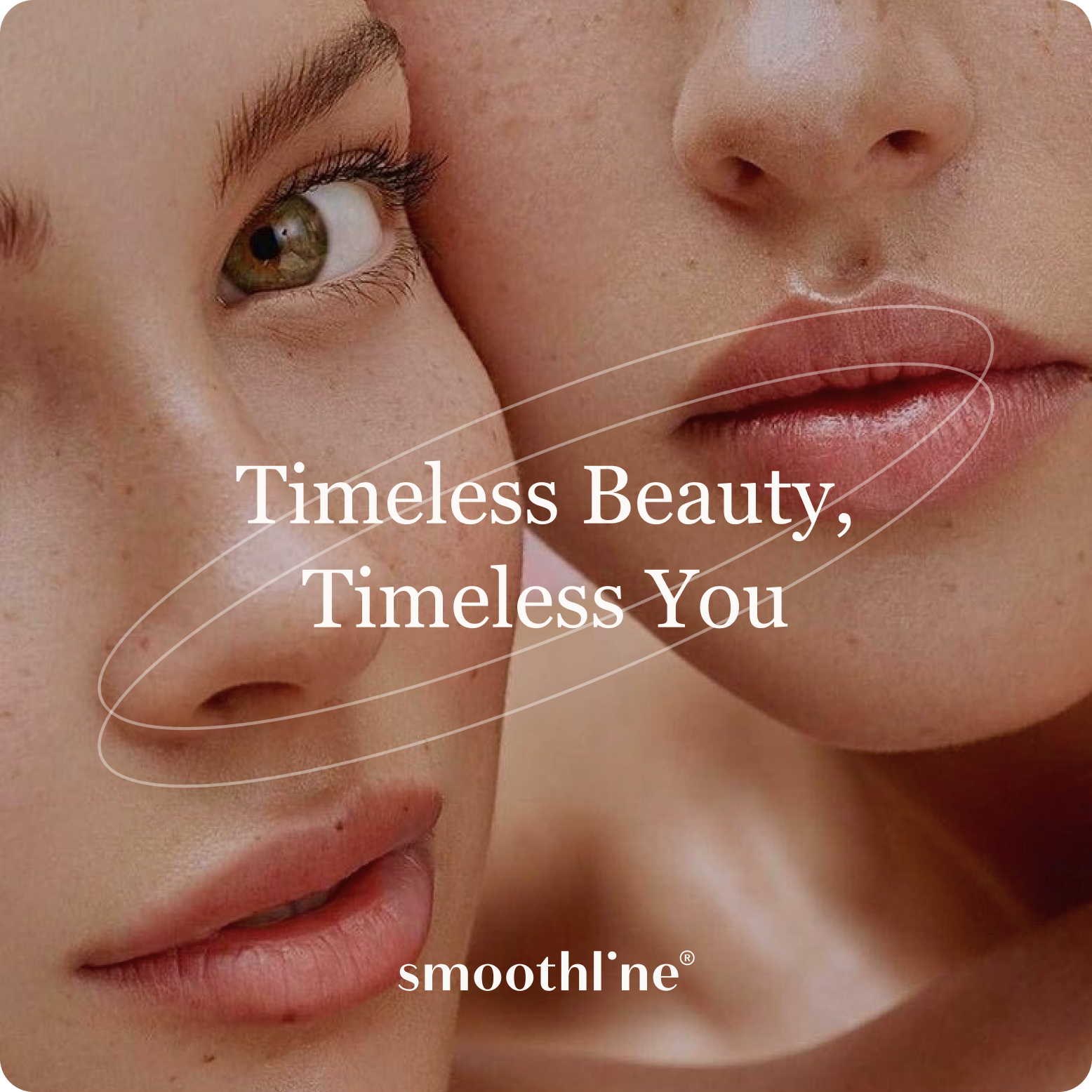Smoothline